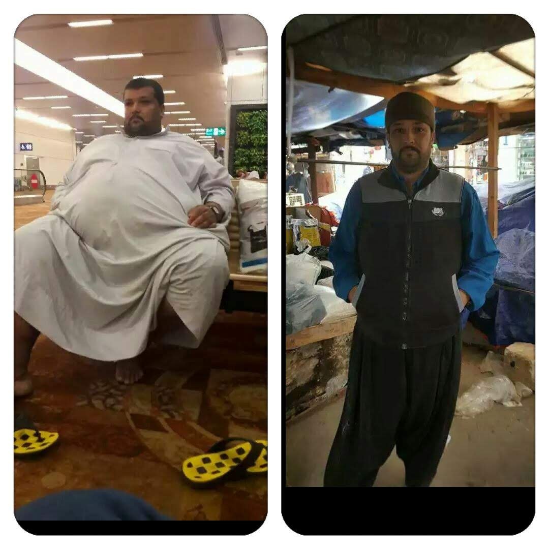 Before after transformation